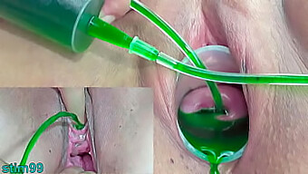 Japanese Mature Women Explore Bdsm And Prolapse Play With Gynecological Procedures